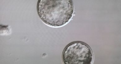 Planujesz embriotransfer. Te przepisy powinieneś znać Planujesz embriotransfer. Te przepisy powinieneś znać